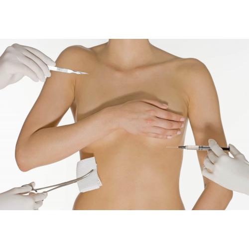 Плюсы и минусы липофилинга для увеличения груди