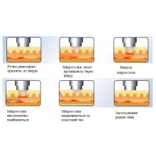 2 в 1 Gold RF Microneedle — професійний апарат RF-мікроголкового ліфтингу
