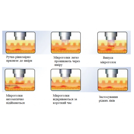 2 в 1 Gold RF Microneedle — професійний апарат RF-мікроголкового ліфтингу