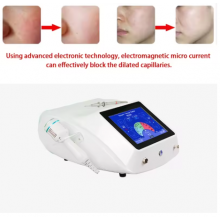 Косметологічний апарат для видалення дрібних судинних утворень VS-90