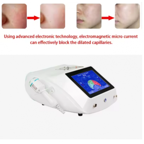 Косметологічний апарат для видалення дрібних судинних утворень VS-90
