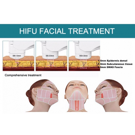 Апарат високоінтенсивного сфокусованого ультразвуку 3 in 1 UMS-HF5 Vaginal + 4D HIFU + Max Machine