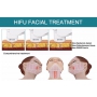 Апарат високоінтенсивного сфокусованого ультразвуку 3 in 1 UMS-HF5 Vaginal + 4D HIFU + Max Machine