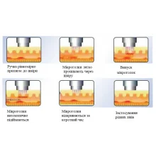 2 в 1 Gold RF Microneedle — професійний апарат RF-мікроголкового ліфтингу 