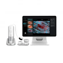 Професійний аналізатор шкіри UMS-3100