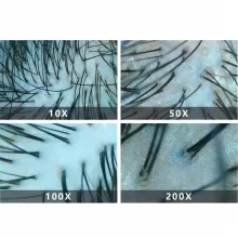 Професійний аналізатор шкіри UMS-3100