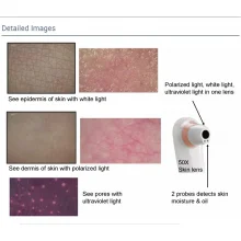 Анализатор кожи и волос UMS-TST-568