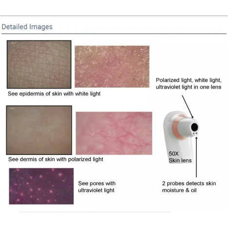 Аналізатор шкіри та волосся UMS-TST-568