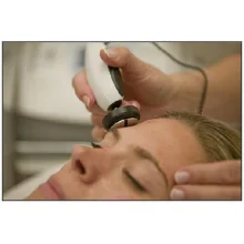 Аппарат для радиочастотного (RF) лифтинга FACE RF 823