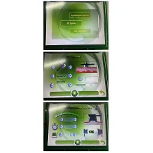 Апарат кріоліполізу CRY-30 з УЗ кавітацією і RF