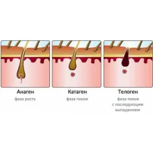 Фотоэпилятор портативный HPLight ( Хепилайт)