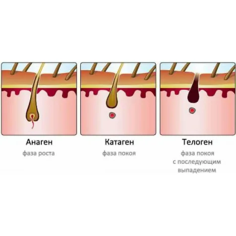 Фотоепілятор портативний HPLight ( Хепілайт)