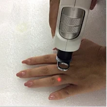 Косметологический лазер ALEX+Nd YAG D-Las 75 new