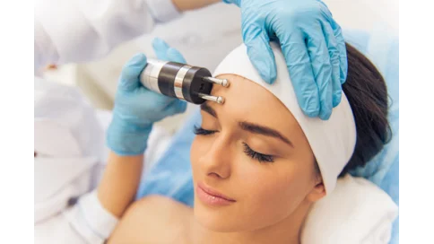 Переваги RF-ліфтингу, про які варто дізнатися