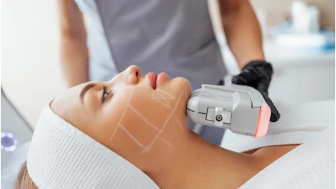 Як апарат SMAS-ліфтингу здатний змінити життя  пацієнта і лікаря